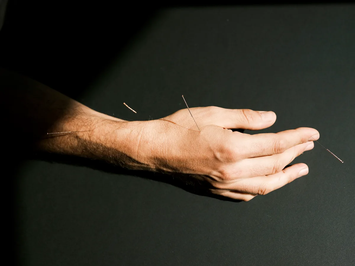 Praxisfoto von Akupunktur & Shiatsu in Berlin – Heilpraktikerin Francesca Pellanda